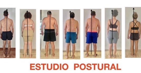 Estudio Postural